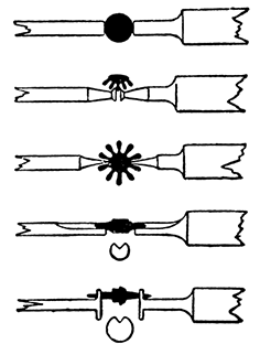 ストッパーの画像